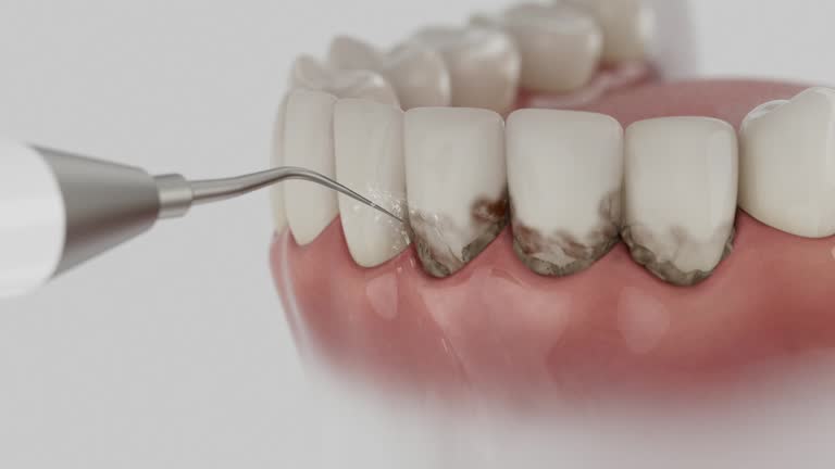 Reliable Dental Crowns And Bridges contractor in Concordia Parish County, LA by Dentist Open Now